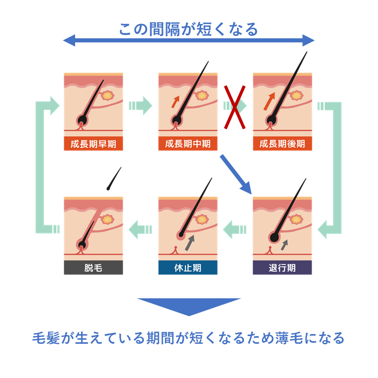 カークランド・ミノキシジル