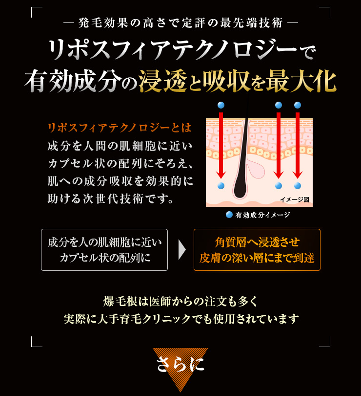 爆毛根ローション